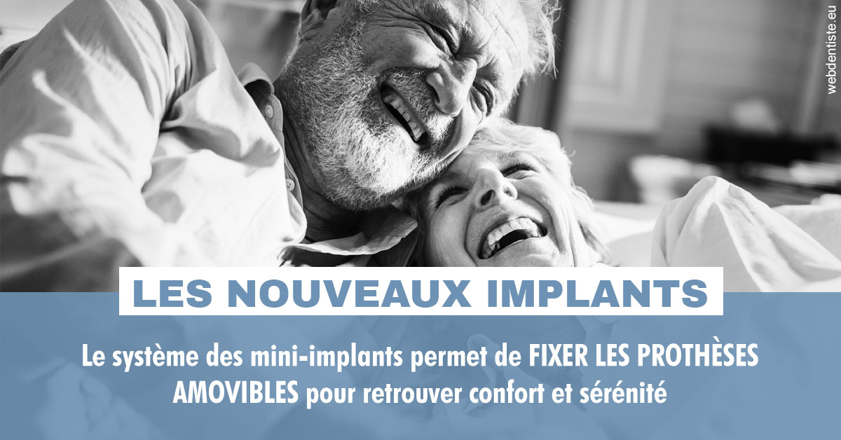 https://dr-asquinazi-ml.chirurgiens-dentistes.fr/Les nouveaux implants 2
