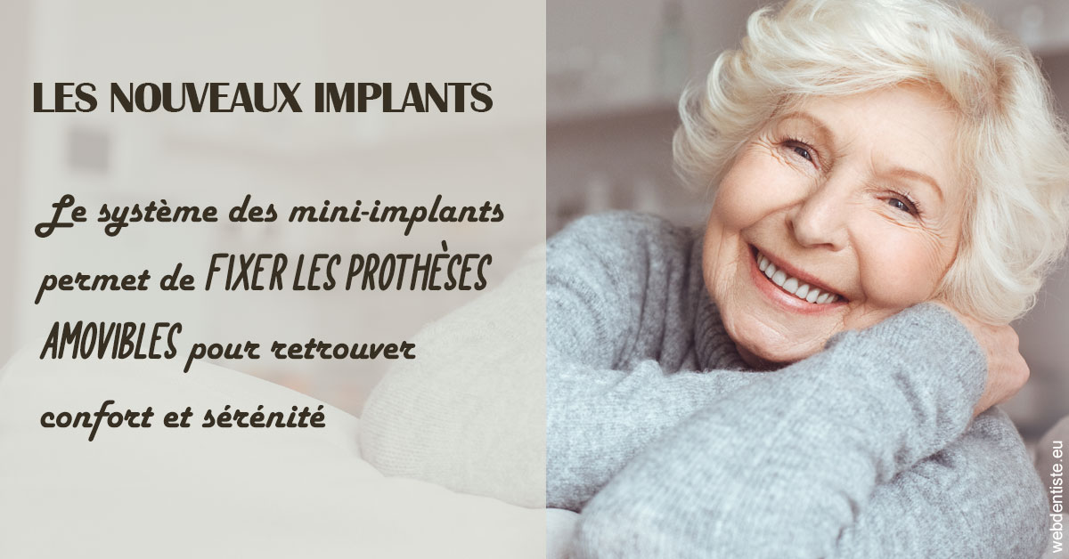 https://dr-asquinazi-ml.chirurgiens-dentistes.fr/Les nouveaux implants 1