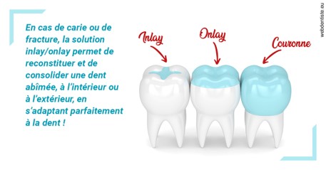 https://dr-asquinazi-ml.chirurgiens-dentistes.fr/L'INLAY ou l'ONLAY