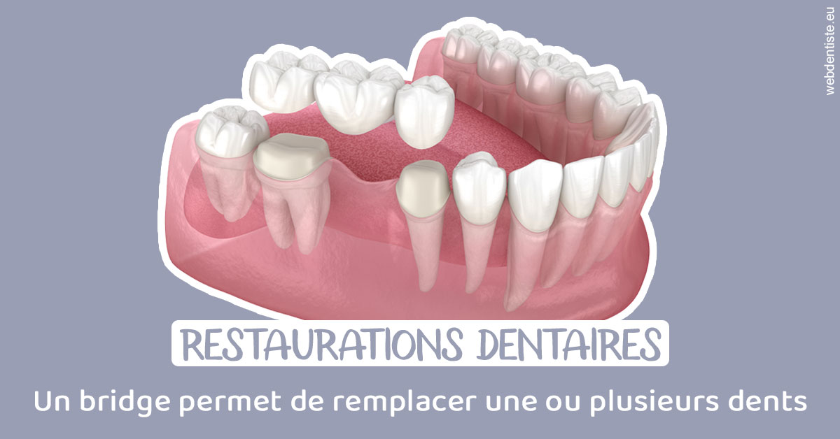 https://dr-asquinazi-ml.chirurgiens-dentistes.fr/Bridge remplacer dents 1
