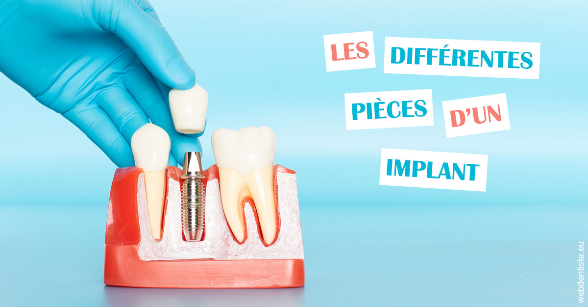 https://dr-asquinazi-ml.chirurgiens-dentistes.fr/Les différentes pièces d’un implant 2