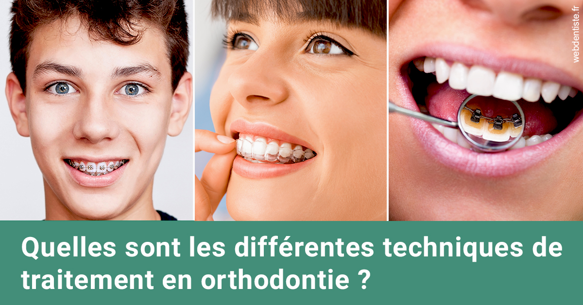 https://dr-asquinazi-ml.chirurgiens-dentistes.fr/Les différentes techniques de traitement 2
