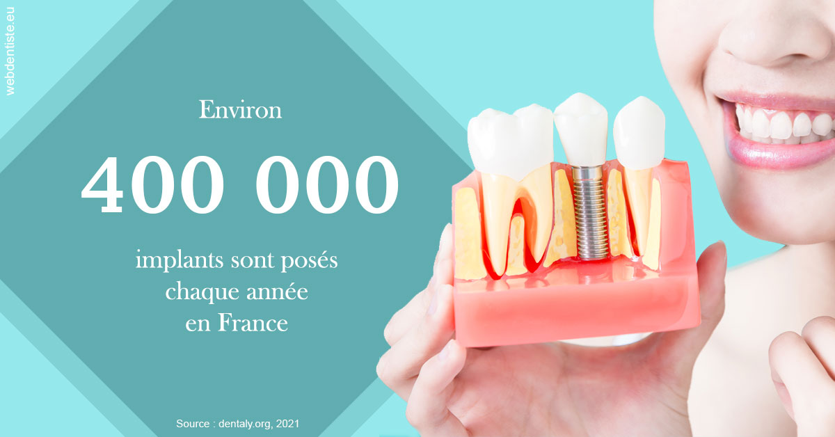 https://dr-asquinazi-ml.chirurgiens-dentistes.fr/Pose d'implants en France 2