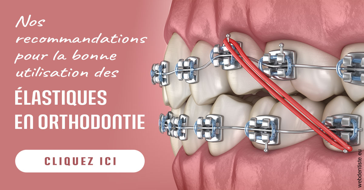 https://dr-asquinazi-ml.chirurgiens-dentistes.fr/Elastiques orthodontie 2